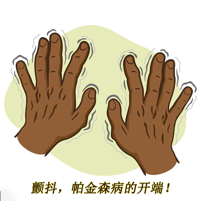 顫抖，帕金森病的開端 帕金森的早期癥狀