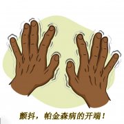 顫抖，帕金森病的開端 帕金森的癥狀有哪些